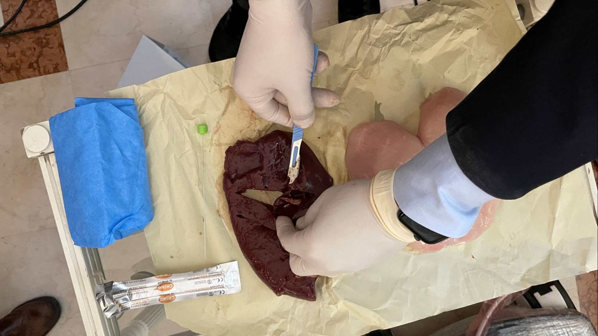 Primo corso teorico pratico internazionale sulle procedure termoablative del nodulo tiroideo
