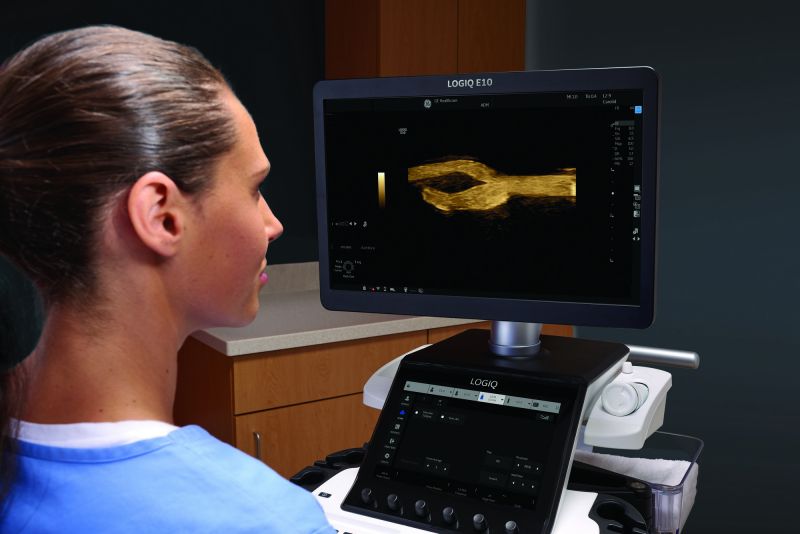 Strumenti basati sull'AI supportati da Edison