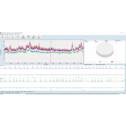 Sistemi Holter ECG