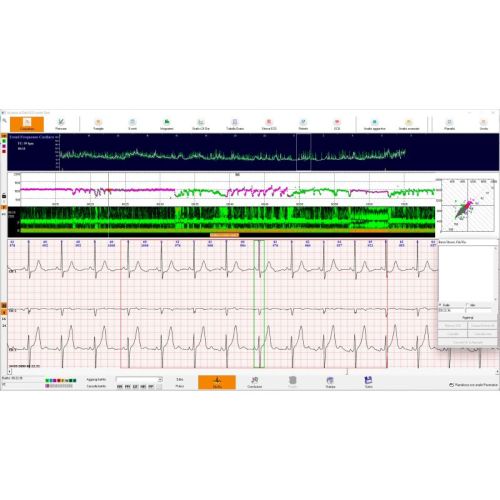 Sistemi Holter ECG