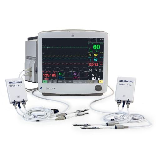 Monitor parametri vitali