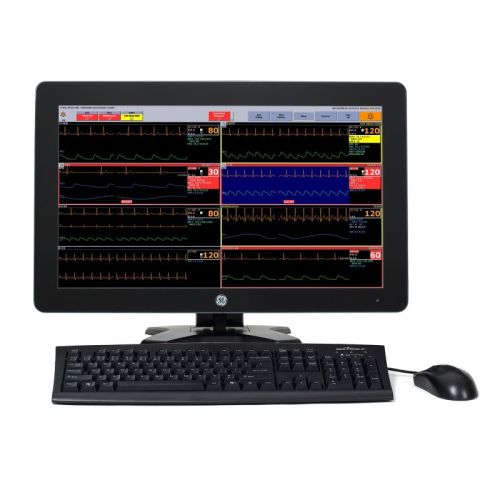Monitor parametri vitali