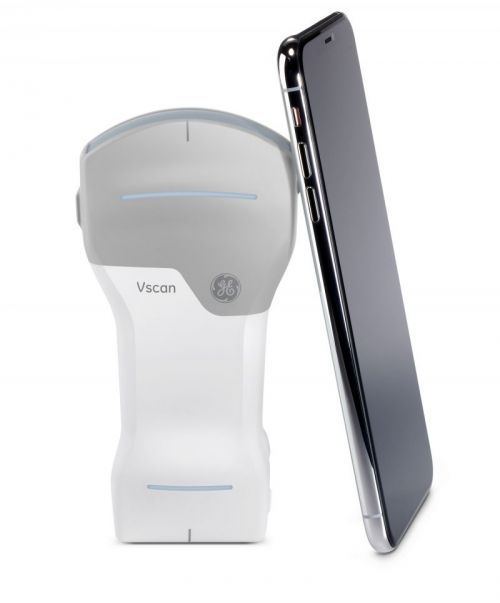 VSCAN
