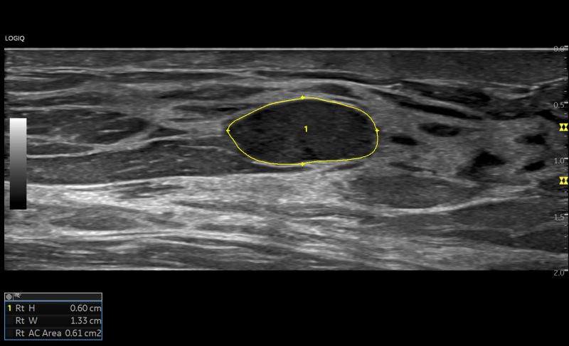 Strumenti per la scansione automatizzata