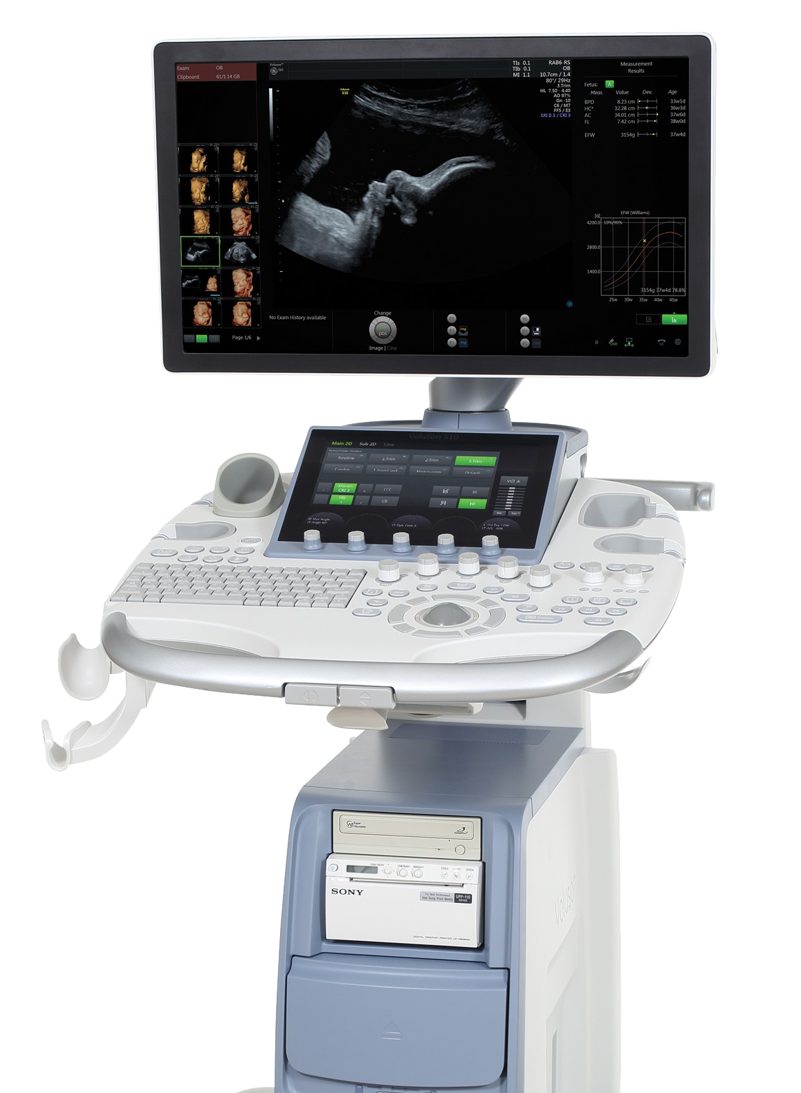 Voluson S10