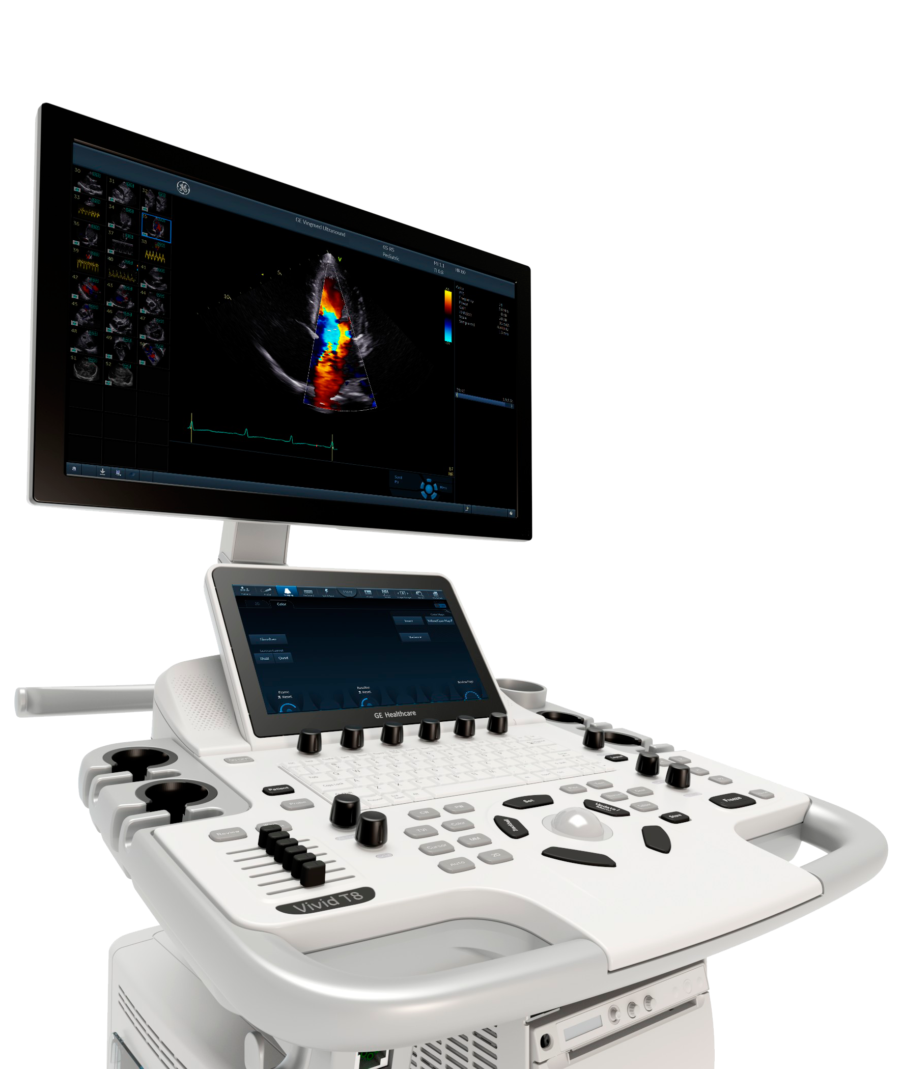 Vivid T8 Ultra Edition