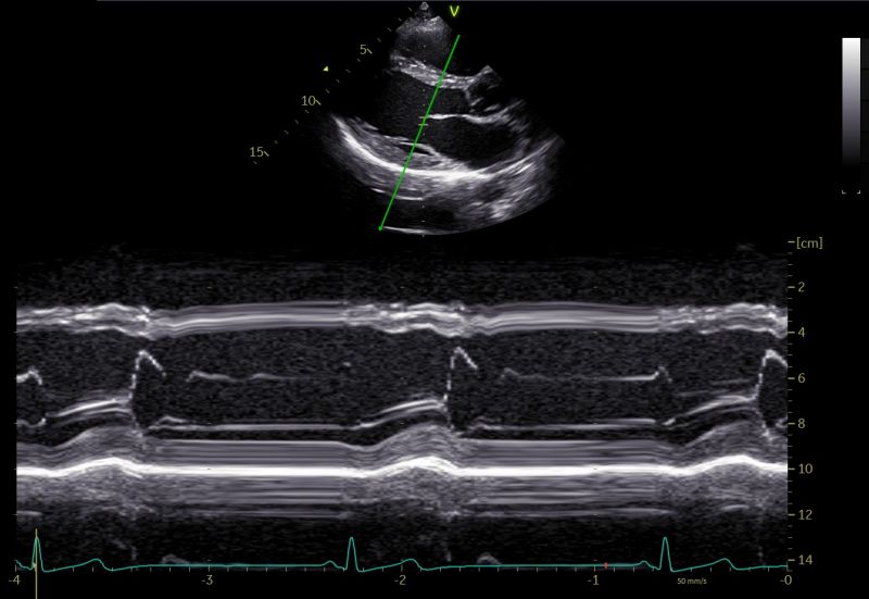 M-Mode anatomico curvilineo