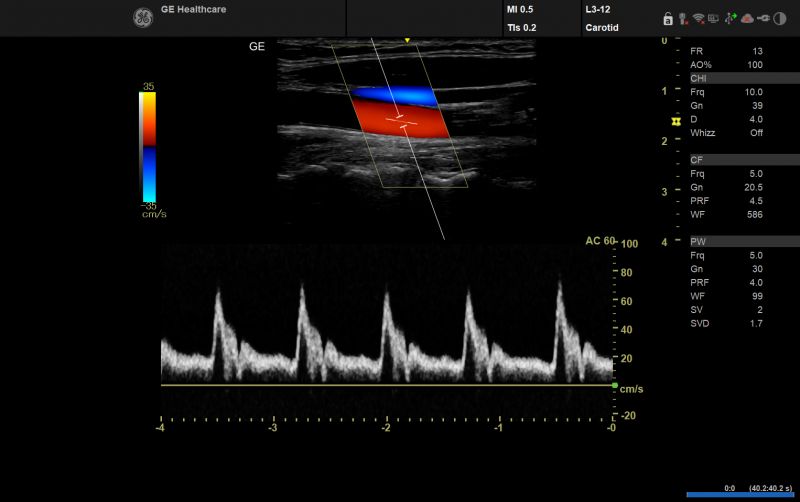 Funzionalità cliniche Whizz