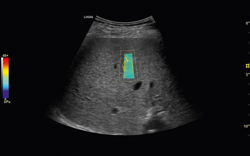 Chiarezza e versatilità XDclear