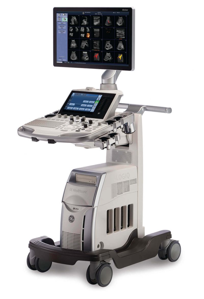 LOGIQ S7 XDclear 2.0