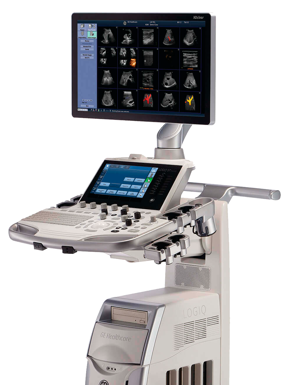 LOGIQ S7 XDclear 2.0