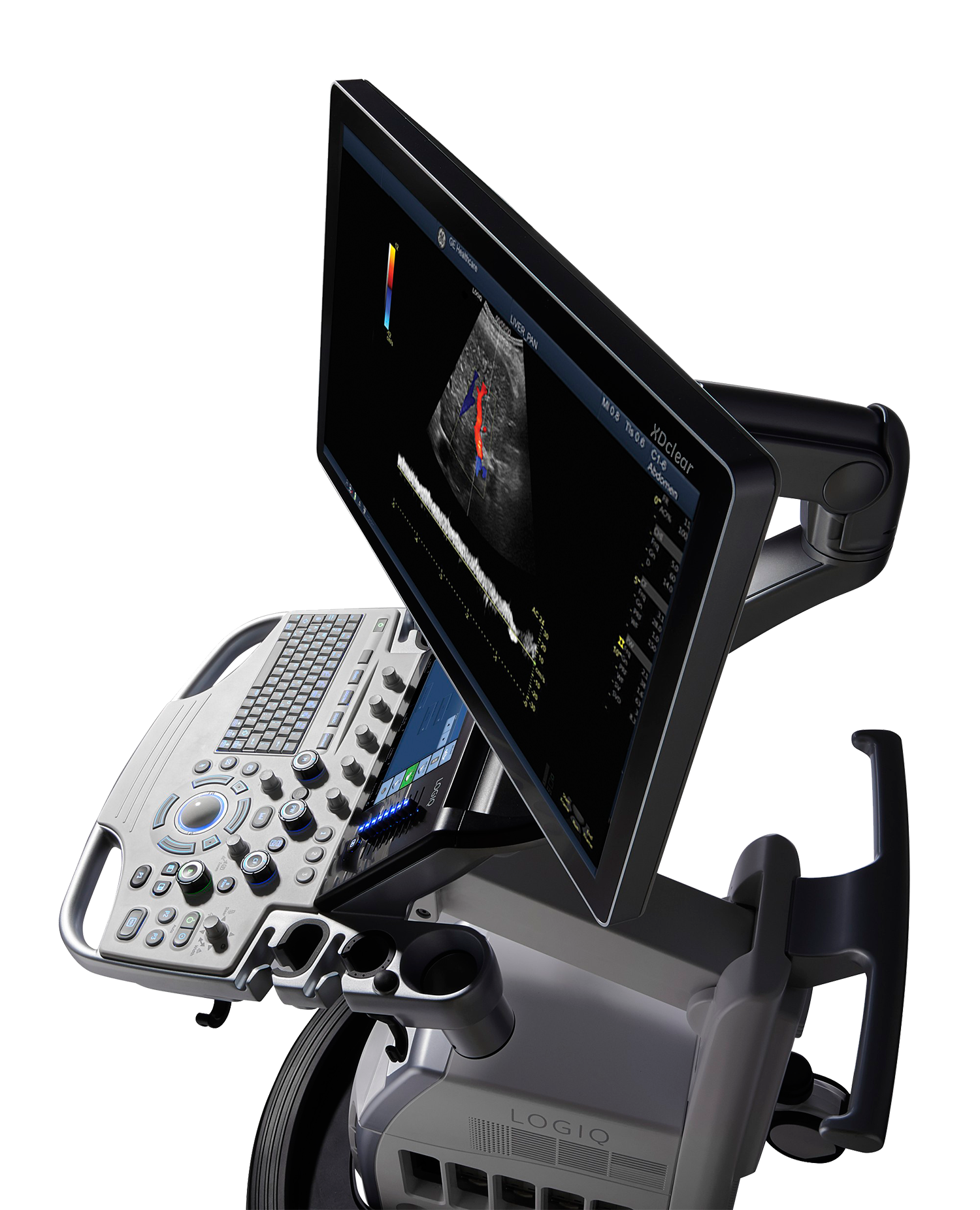 LOGIQ S7 XDclear 2.0