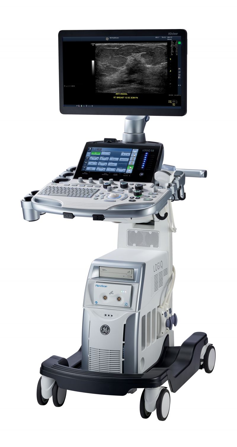 LOGIQ S8 XDclear 2.0