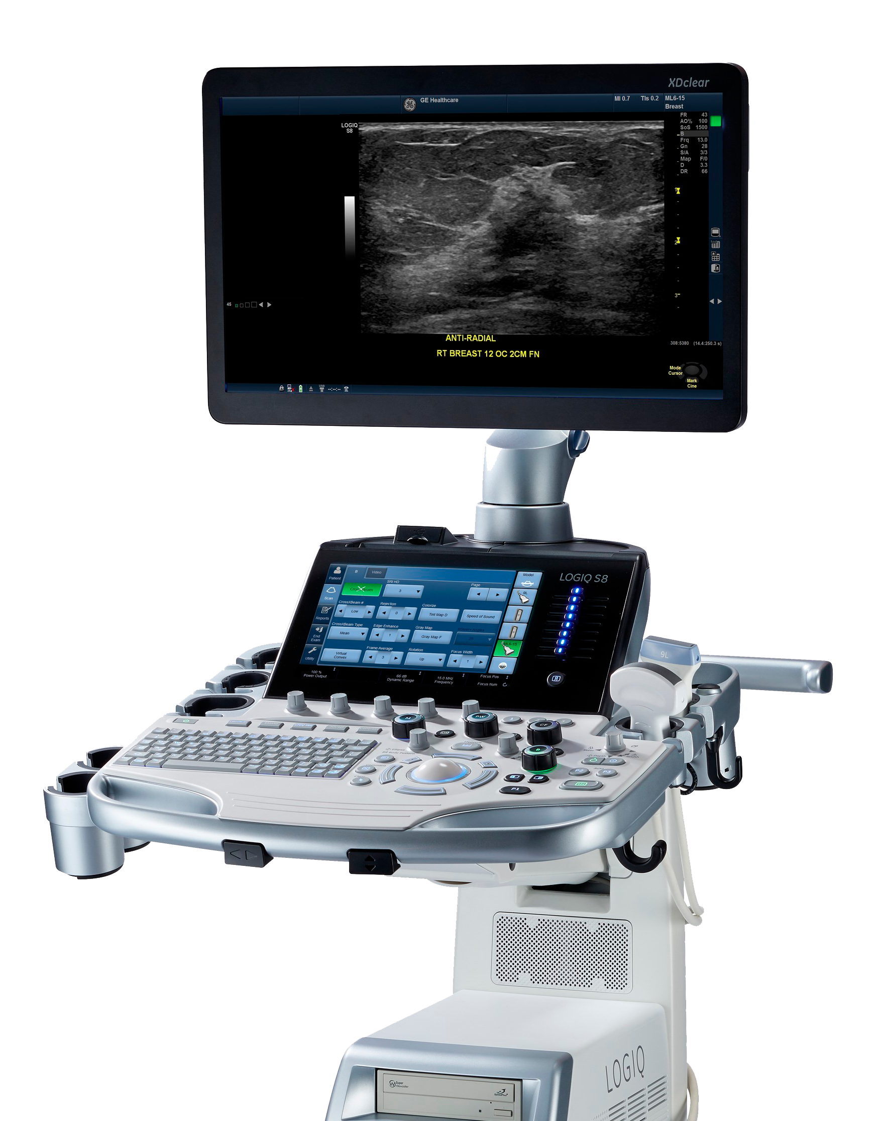 LOGIQ S8 XDclear 2.0