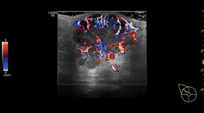 Imaging con B-Flow HD Color