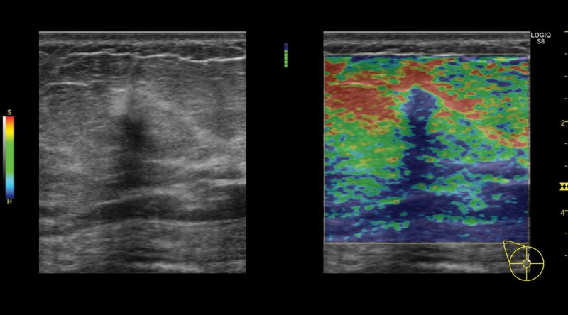 Chiarezza e versatilità XDclear