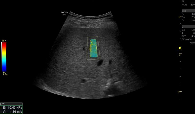 Navigazione volumetrica